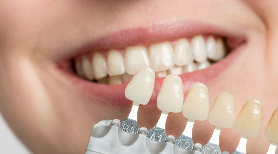 Types Of Dental Problems