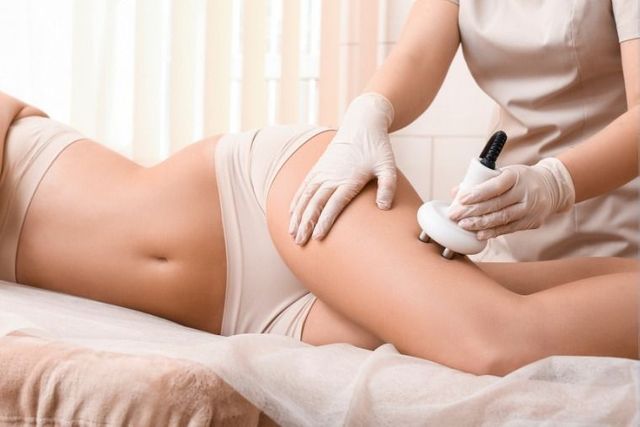 Body Contouring Options